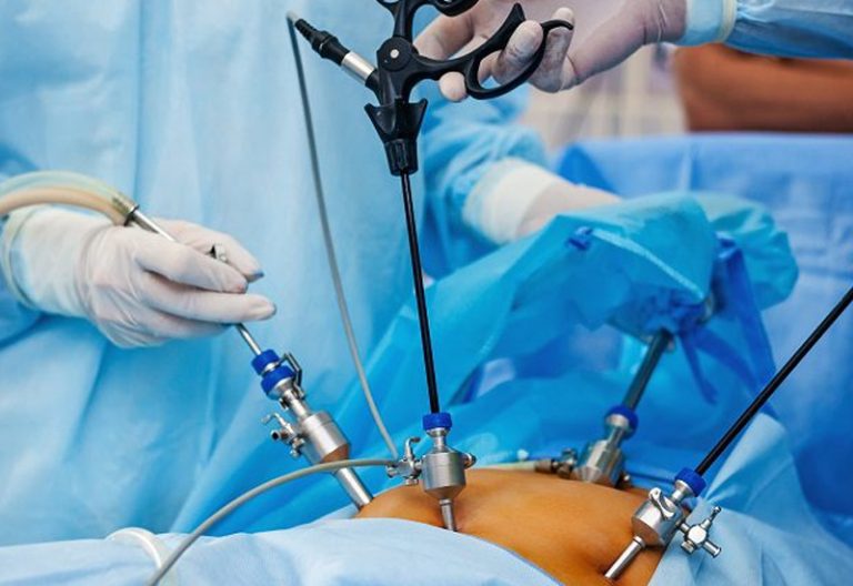 General & Laparoscopic Surgery - Neurospine Hospital & Revive Critical Care